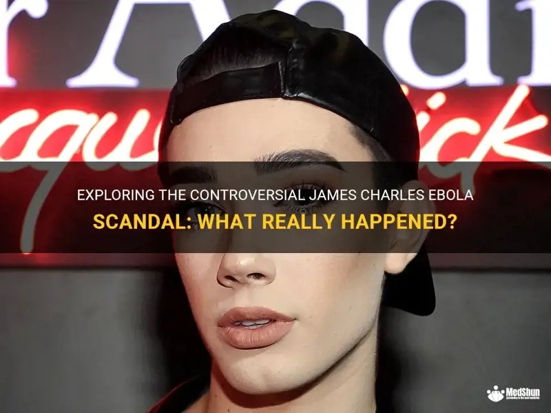 Exploring The Controversial James Charles Ebola Scandal What Really