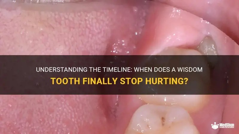 Understanding The Timeline When Does A Wisdom Tooth Finally Stop