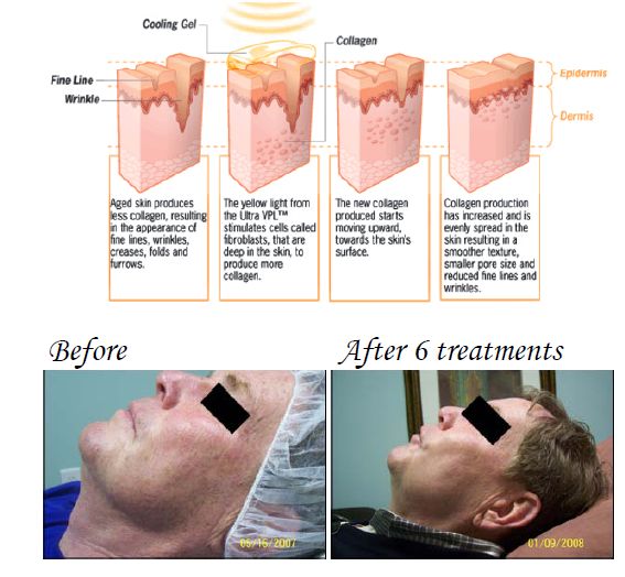 Collagen Production The Med Spa
