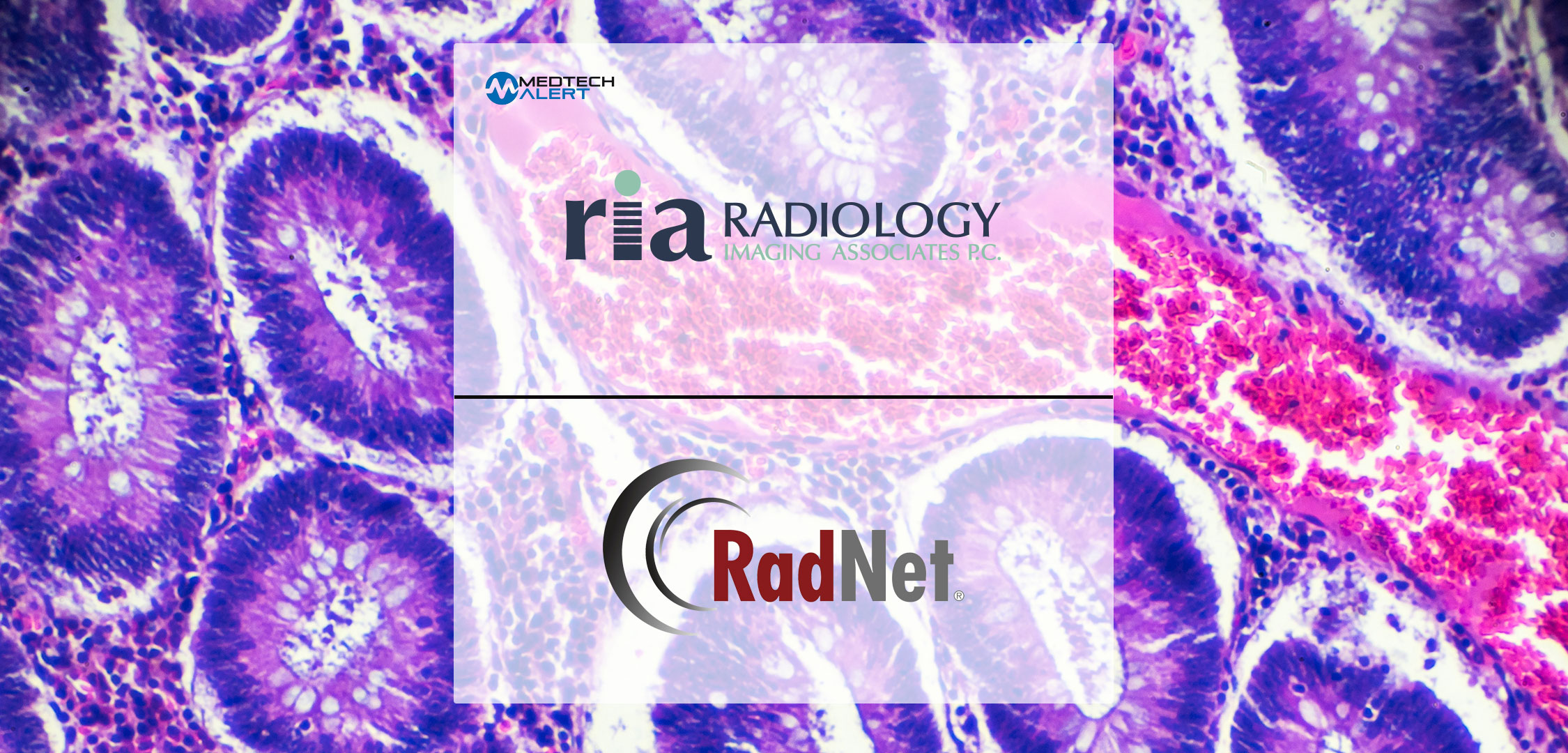 Radiology Imaging Associates Launches the Enhanced Breast Cancer