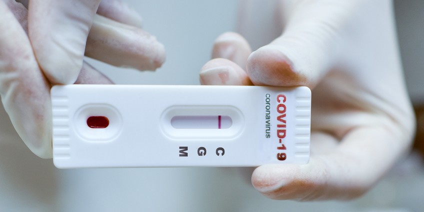 Test Na Przeciwcial Koronawirus / Enel Med Wprowadza Do Oferty Test Na