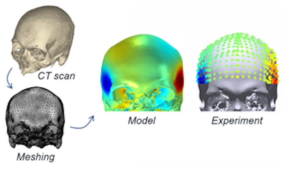 The Science of Sound, Vibration to Better Diagnose, Treat Brain