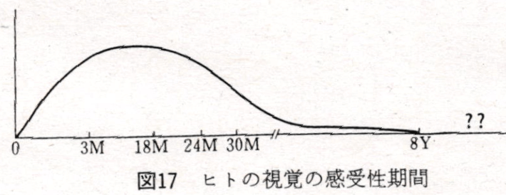 小児の白内障 目医者情報