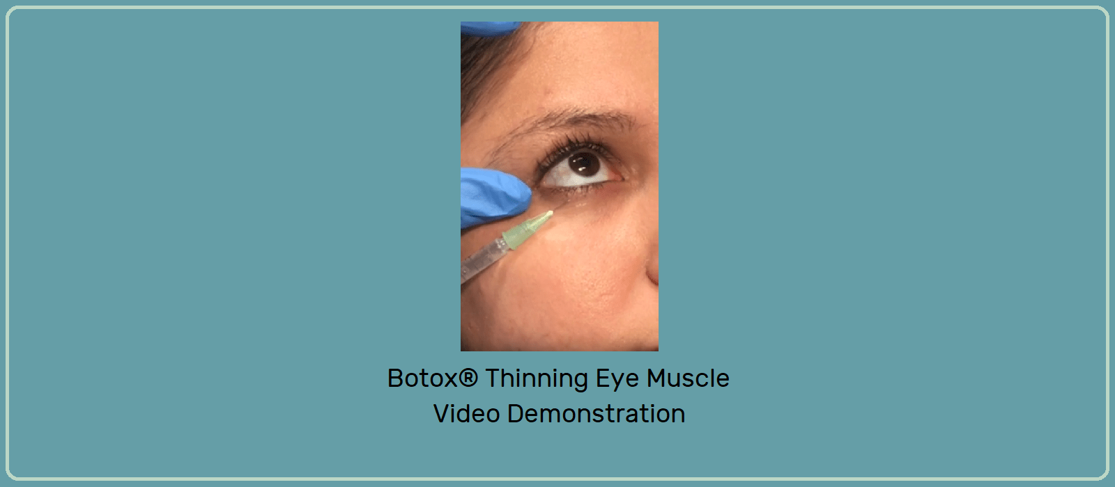 Thinning eye muscle Melanie Ho Erb, M.D.