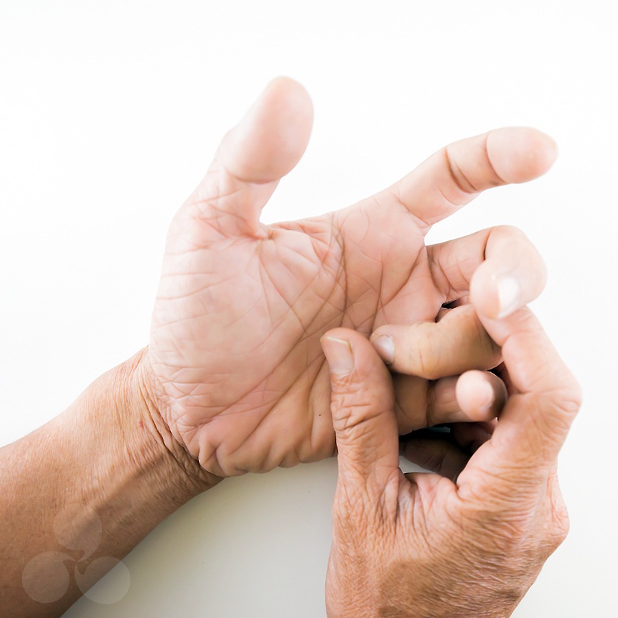 Trigger Finger Treatment Melbourne Hand Rehab