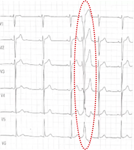 7+ 保険 点数 Mri Article