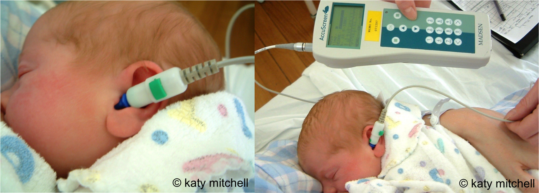 Understanding Hearing Loss MESHGuides