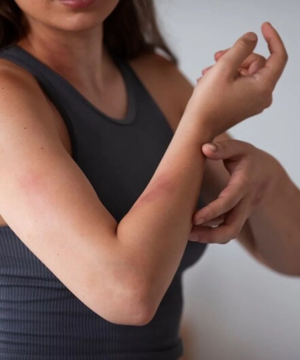 Rash Treatment near Moorestown, NJ Get Relief Today!