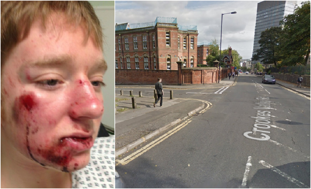 Cyclist hit by car in Sheffield told by passenger 'I can't stop to