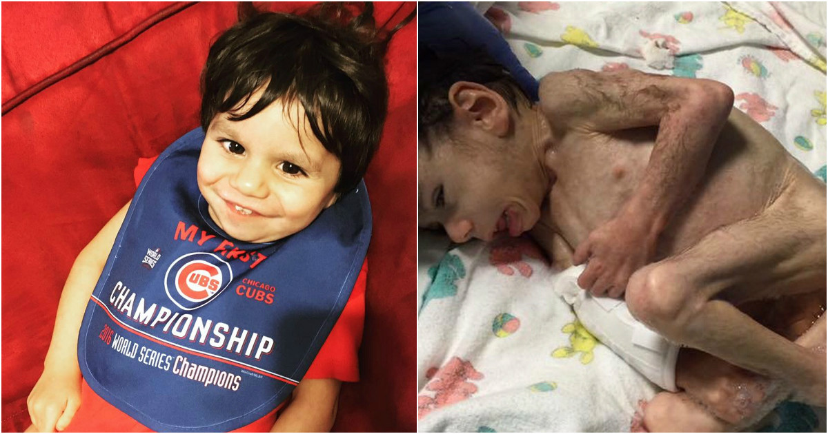 Orphan covered in hair from malnutrition after being starved for seven years Metro News