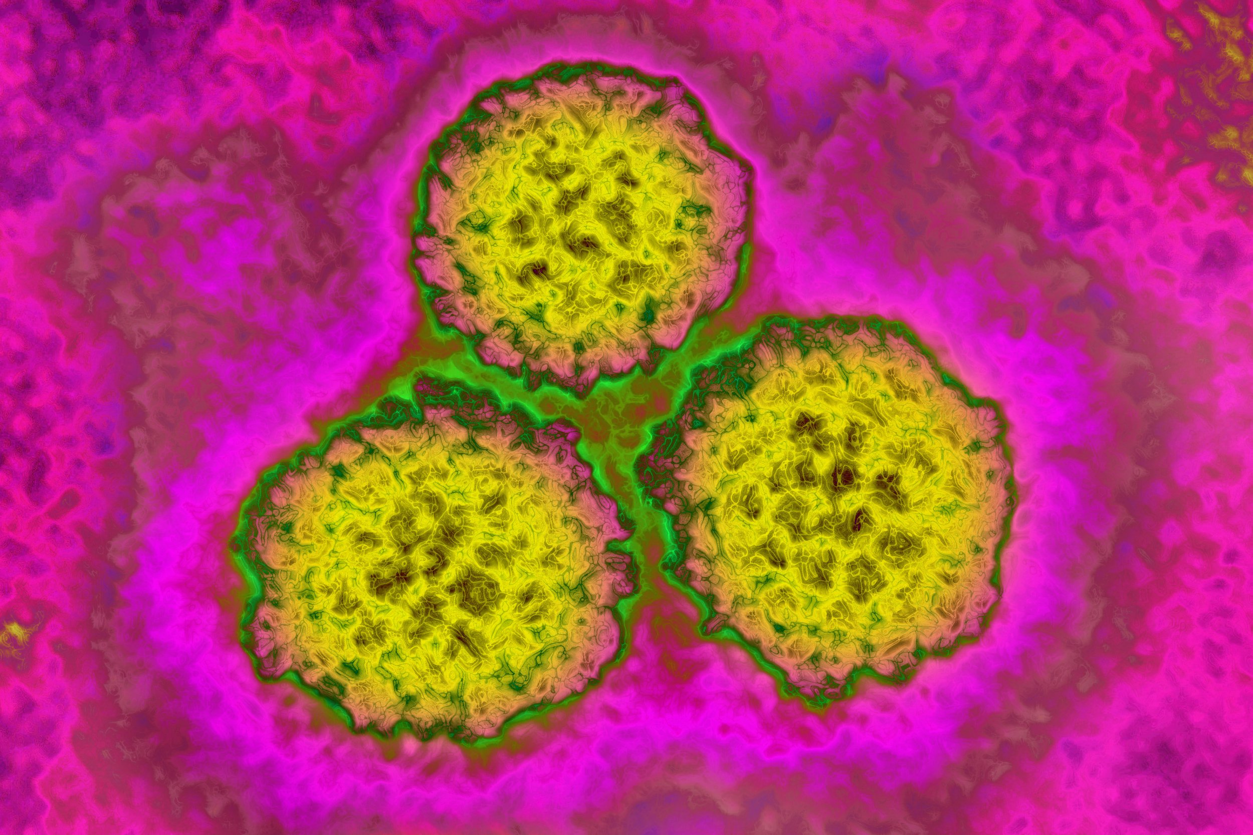Papilloma virus, HPV). It causes cervical cancer. Image taken with transmission electron microscopy