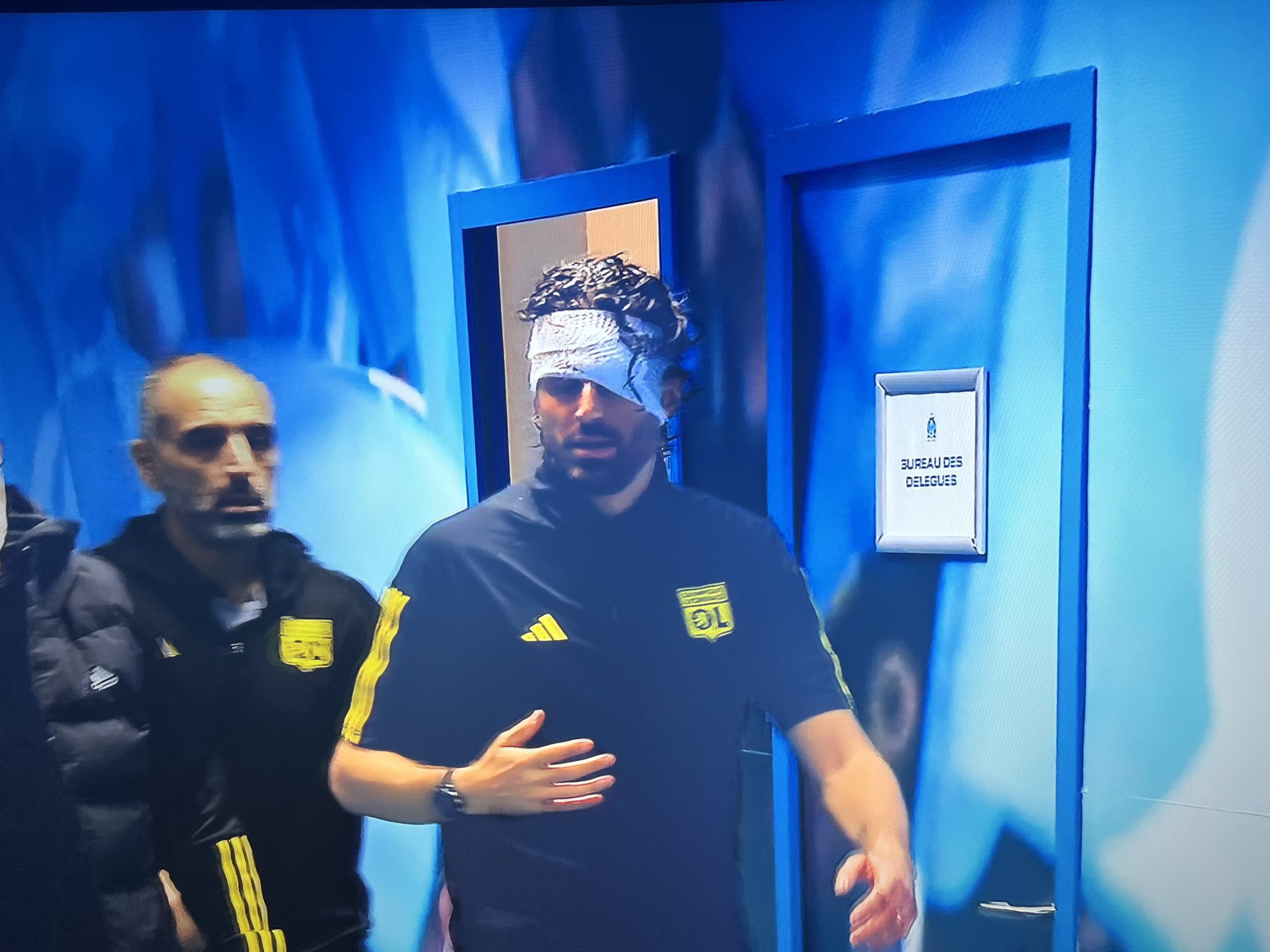 Lyon manager Fabio Grosso 'seriously injured' as team bus attacked in