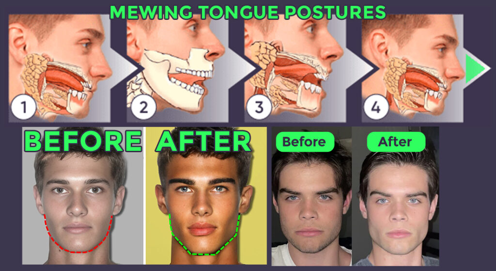 Body Fat Percentage Affects Jawline Here Is How Mewing.coach