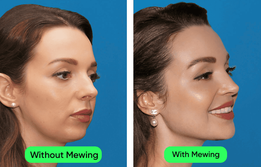 5 Reasons Why Your Cheekbones Could Appear So Big Mewing.coach