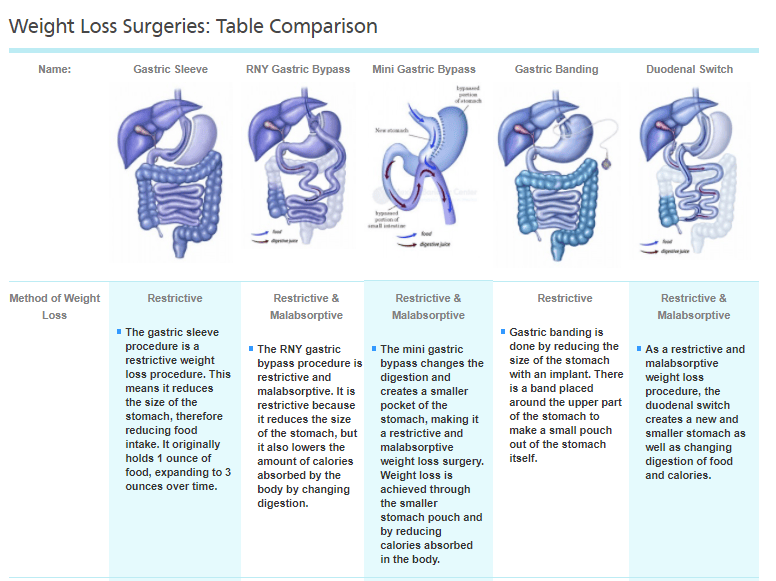 Bariatric Surgery Options Which Option is Best for Me? MBC