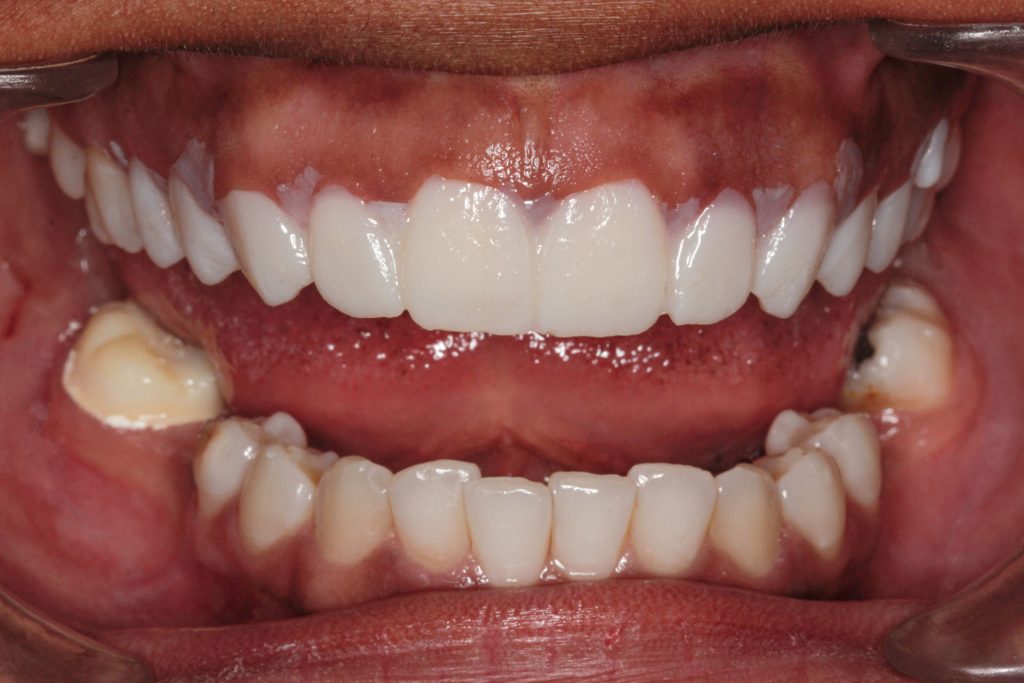 Esthetic Dental Surgery Case Study