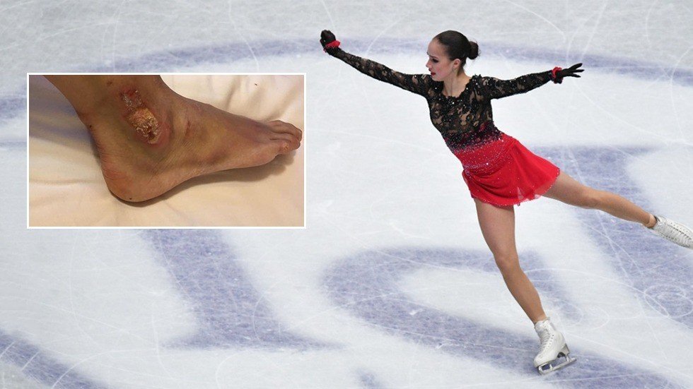 Price of success Olympic champ Zagitova skated with severe blisters at