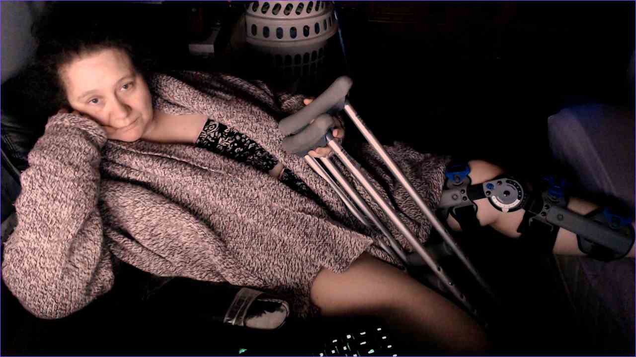 Broken Leg in Recovery
