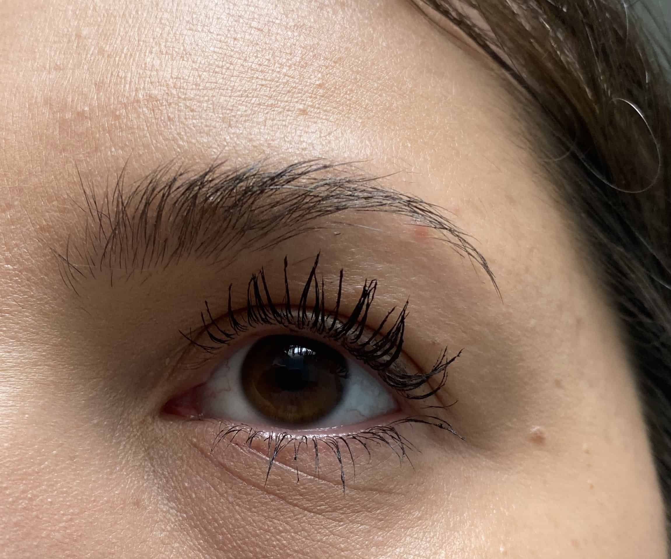 Pimples In Eyebrow Treatments + How To Avoid Them [Guide] Hello Mia