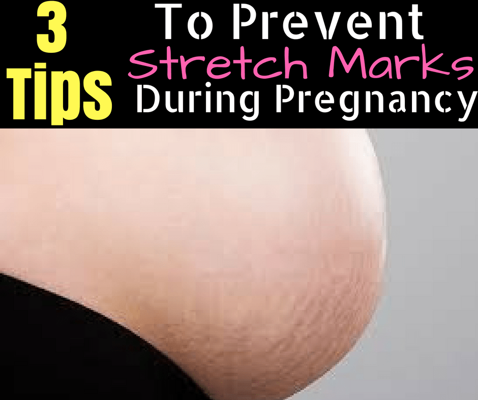 Pregnancy and Stretch Marks Michelle Marie Fit