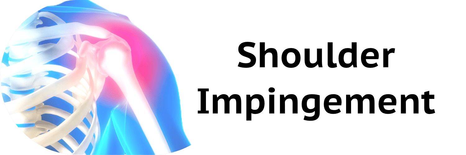 Shoulder Impingement Syndrome MiChiro