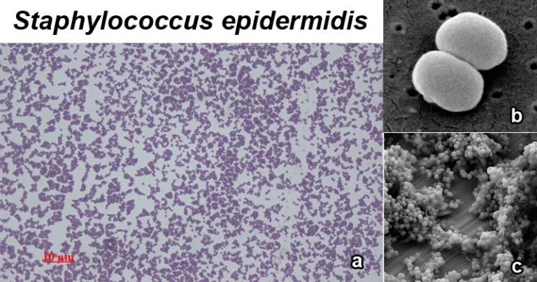 Staphylococcus epidermidis An Overview Microbe Notes