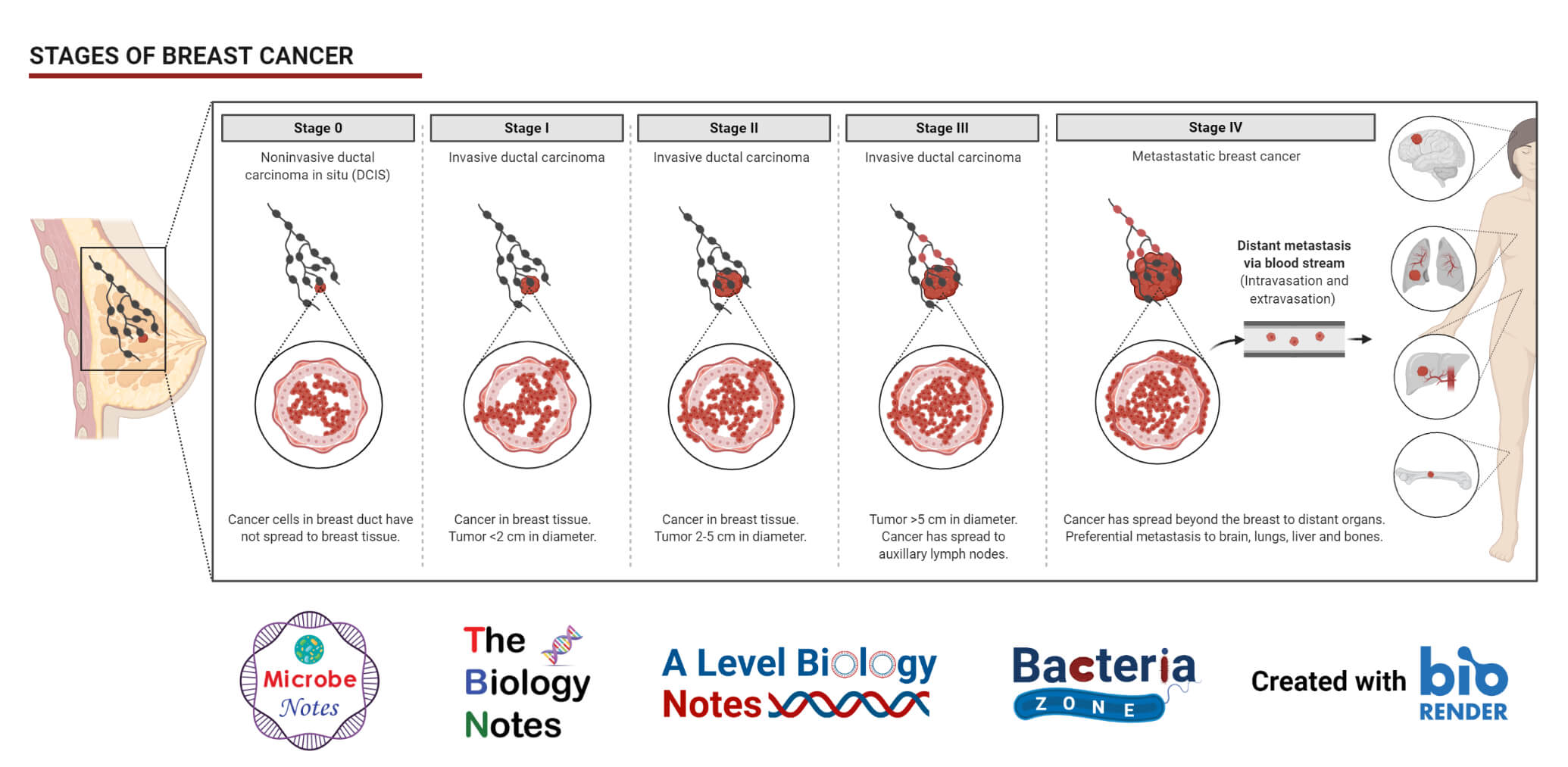 Breast Definition, Structure, Functions and Breast Cancer