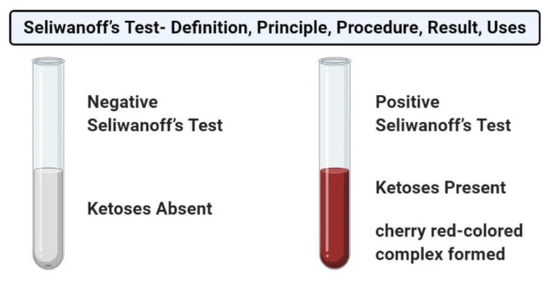 Seliwanoff’s Test Definition, Principle, Procedure, Result, Uses