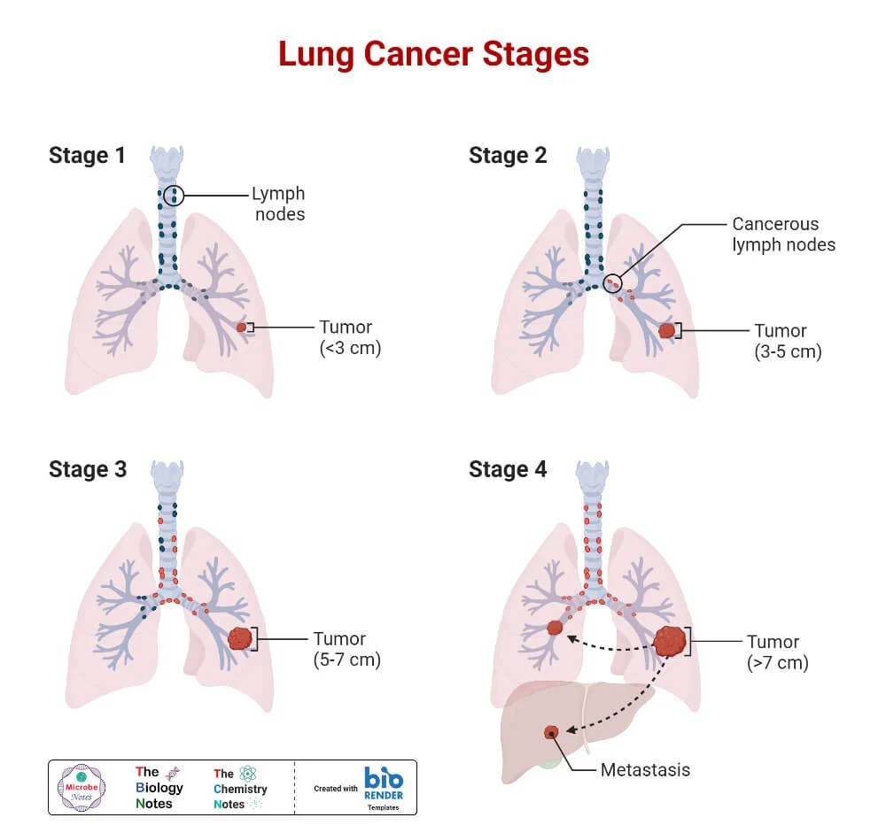 Lungs Definition, Structure, Location, Functions, Diseases