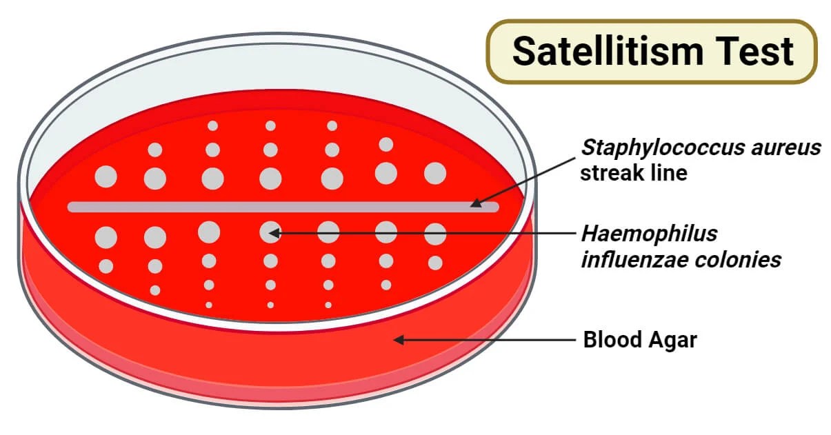 Satellitism Test Principle, Media, Procedure, Results, Uses