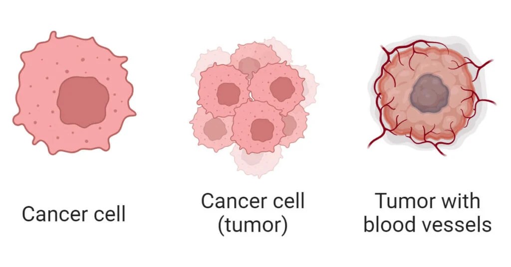 Cancer Cells Definition, Morphology, Types, Development