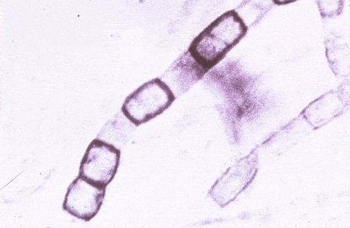 Dimorphic fungi and their properties - Learn Microbiology Online
