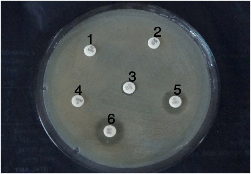 Antibiotic Resistance Origin, Causes, Mechanism • Microbe Online