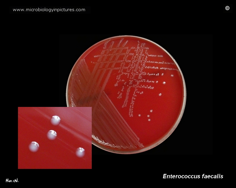 Enterococcus faecalis Properties, Pathogenesis, Lab Diagnosis