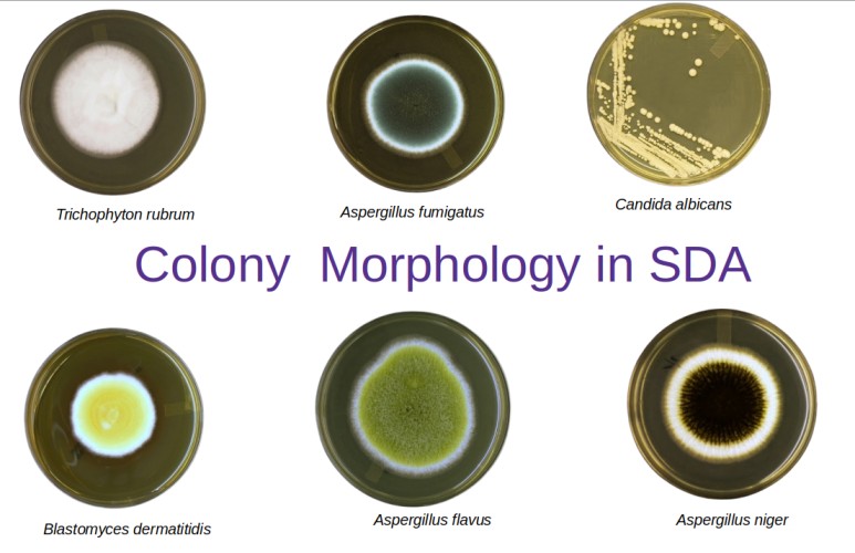 Sabouraud Agar (SDA) Composition, Uses, Colony Morphology