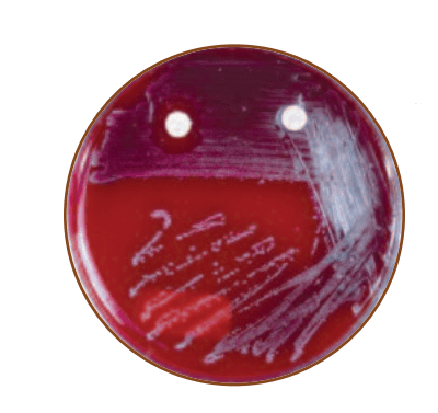 SXT Testing: Principle, Procedure, and Results • Microbe Online