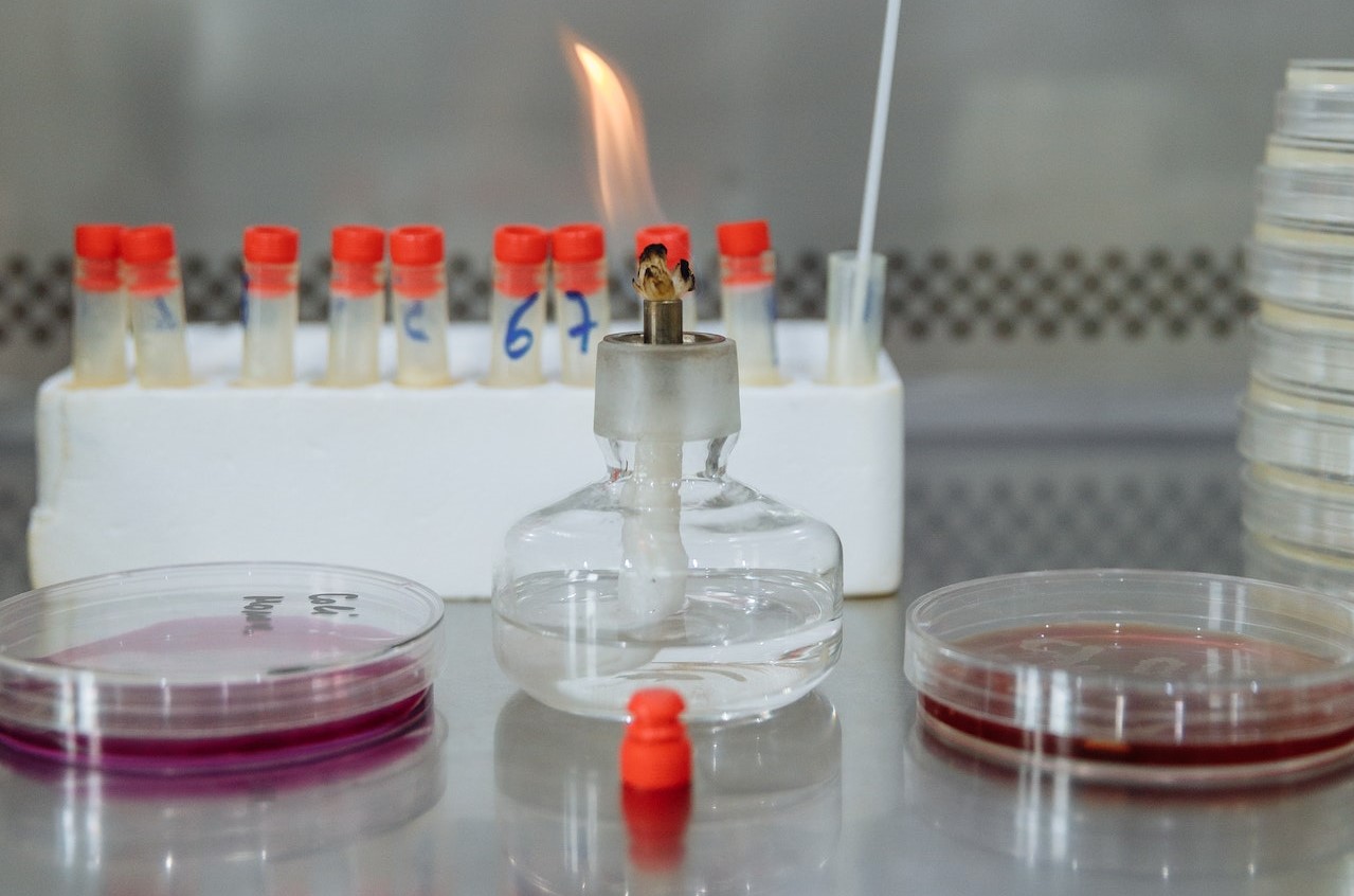 Culture media Preparation Best ways to avoid contamination