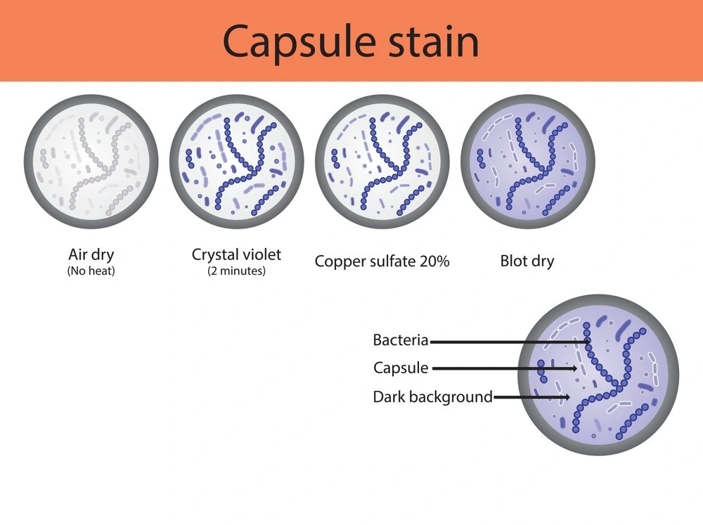 Capsule Stain Its Principle, Reagents, Procedure, and Results