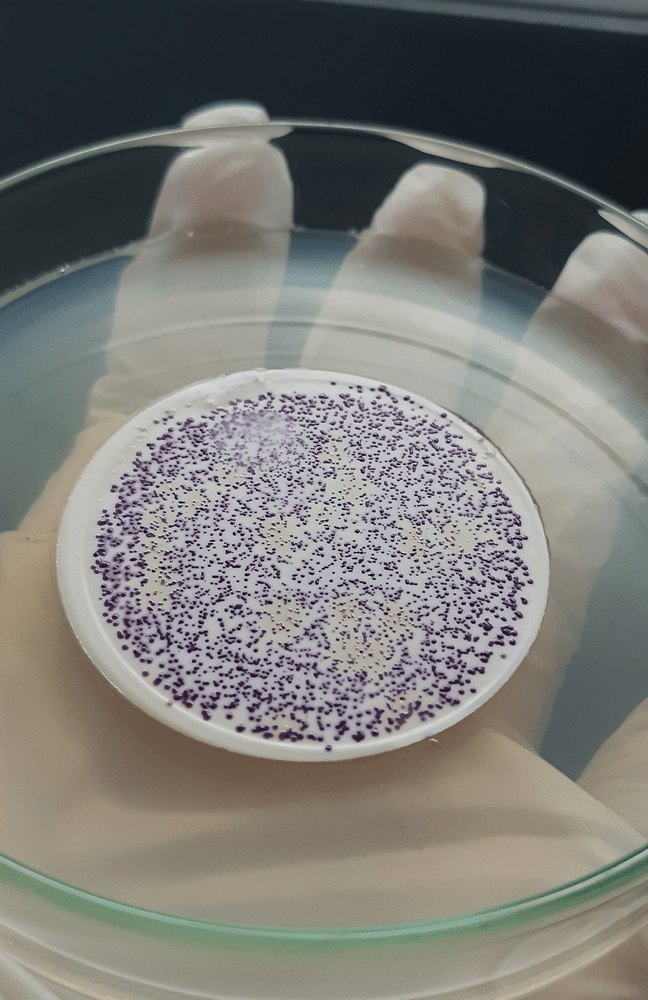 Membrane Filter Technique Its Principle, Procedure, and Results
