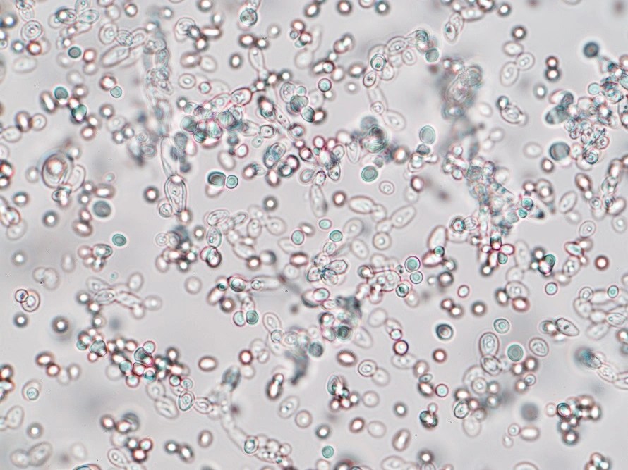 How to Identify Yeast by using different Techniques