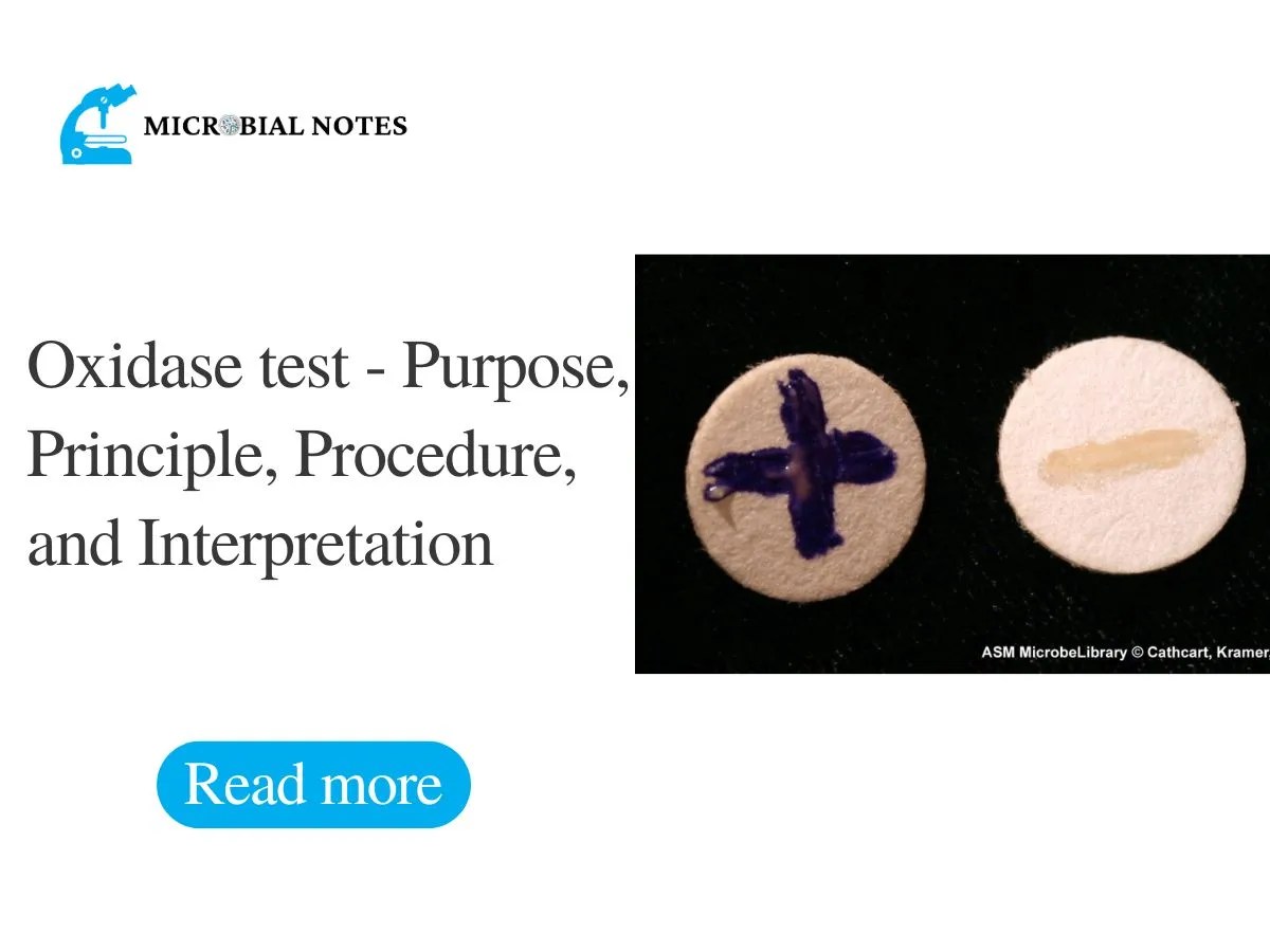 Oxidase test Purpose, Principle, Procedure, and Interpretation
