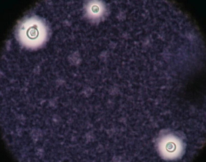 India Ink Staining Principle, Procedure, and Results Microbial notes