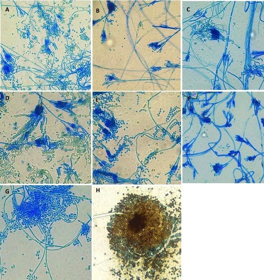 Lactophenol cotton blue staining Microbial notes