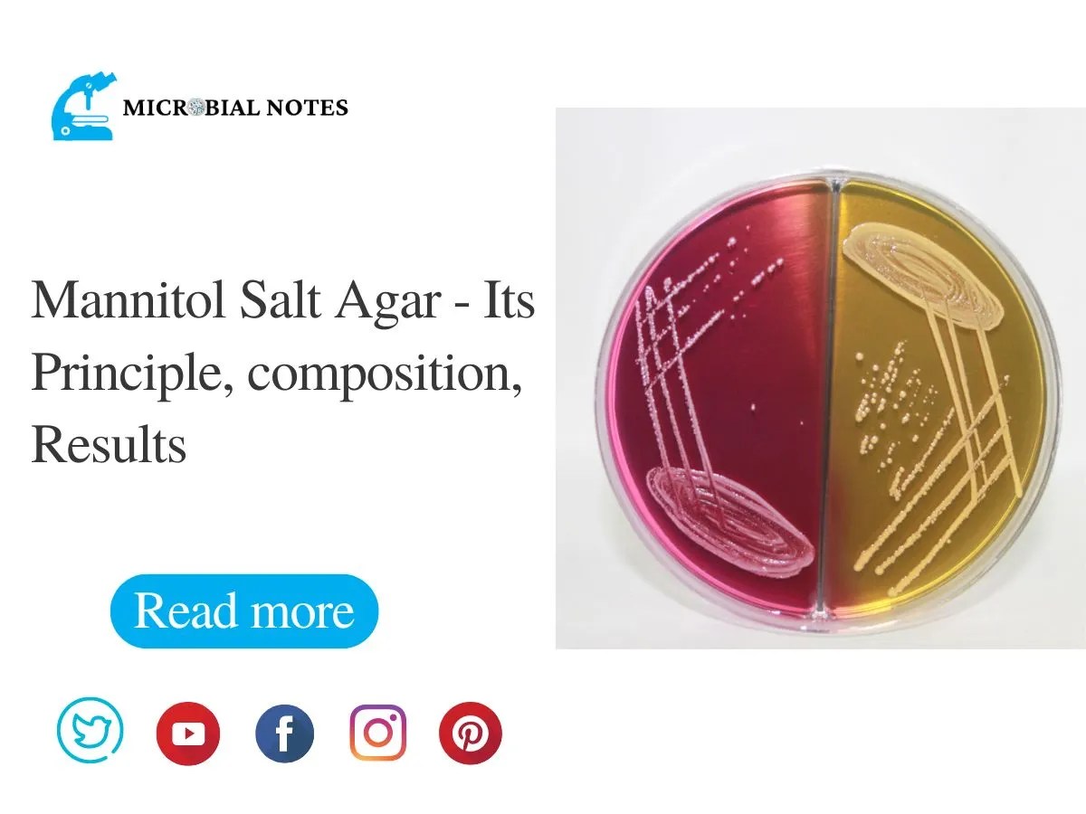 Mannitol Salt Agar Its Principle, composition, Results