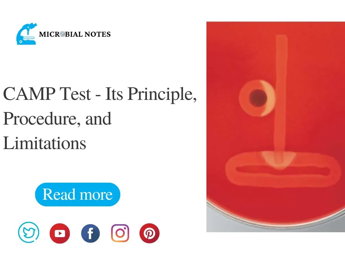 CAMP Test Its Principle, Procedure, and Limitations