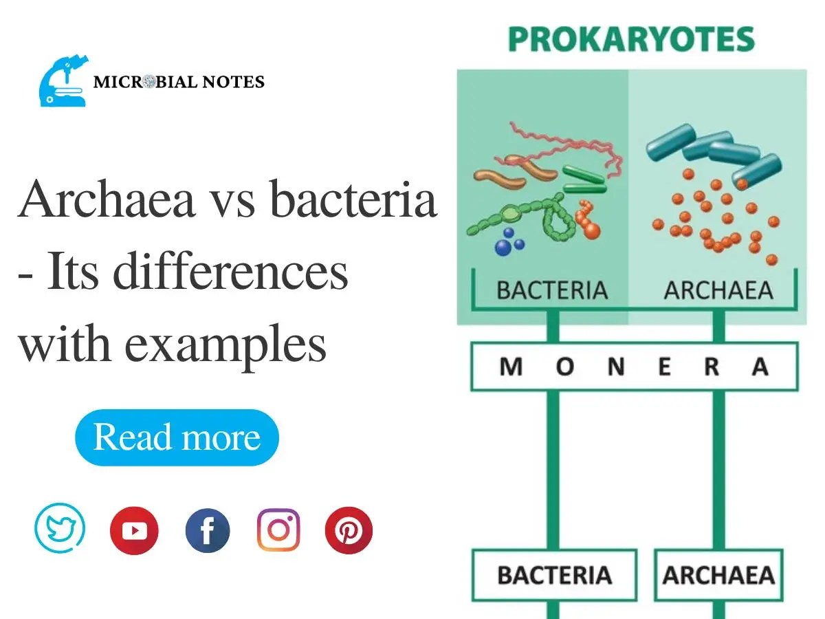 Archaea vs bacteria- Its differences with examples - Microbial notes