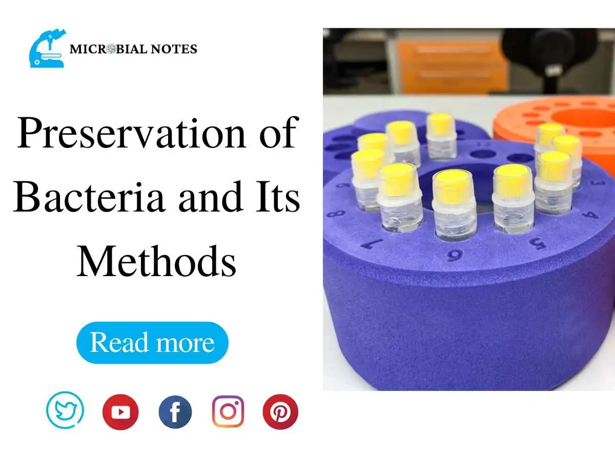 Preservation of Bacteria and its Methods Microbial notes