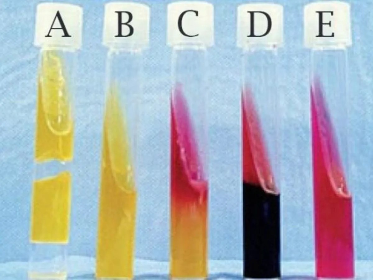 Kligler's Iron Agar (KIA) Test Microbial notes