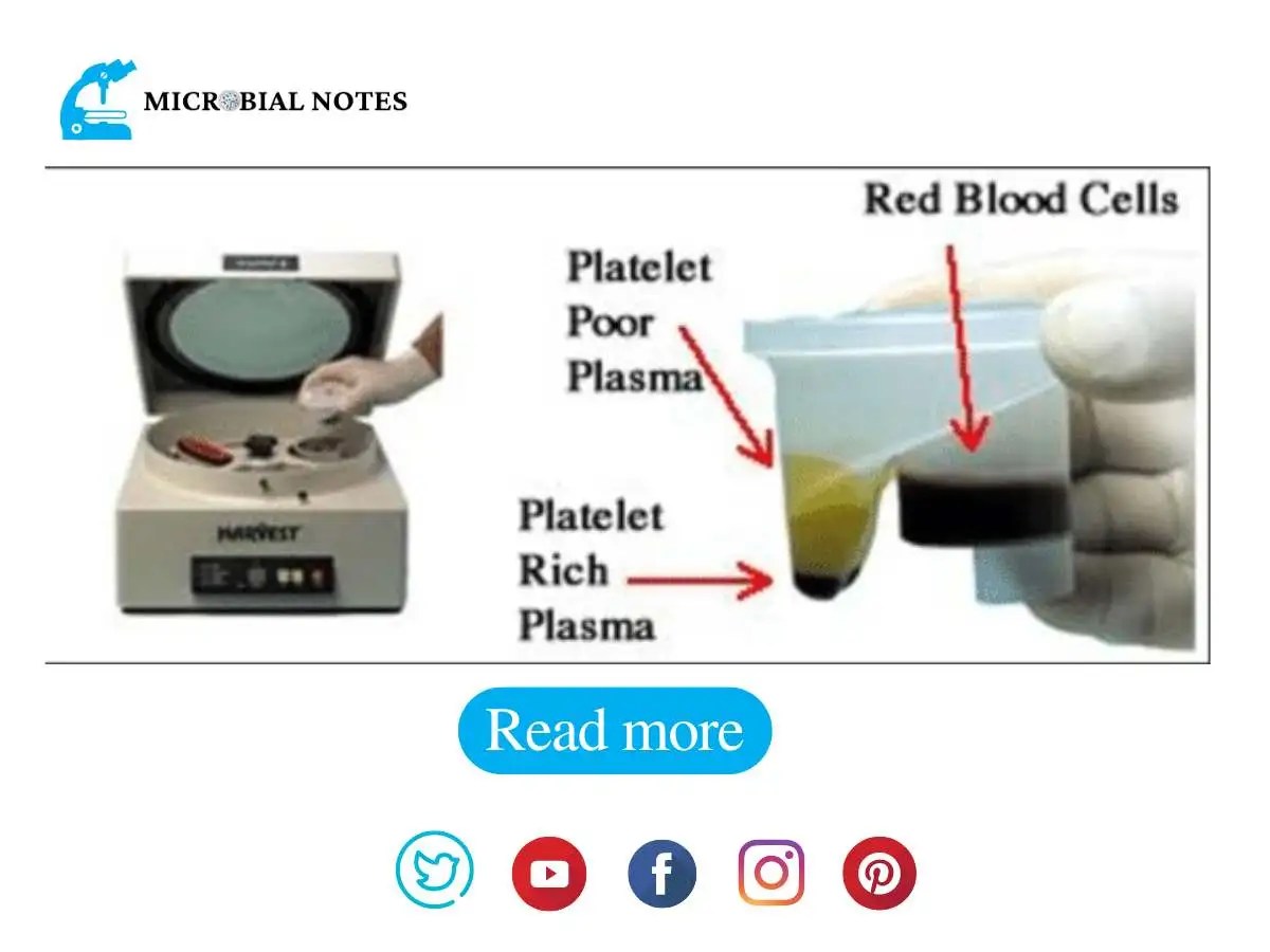 PRP Centrifuge Machine Its Principle, Procedure and uses