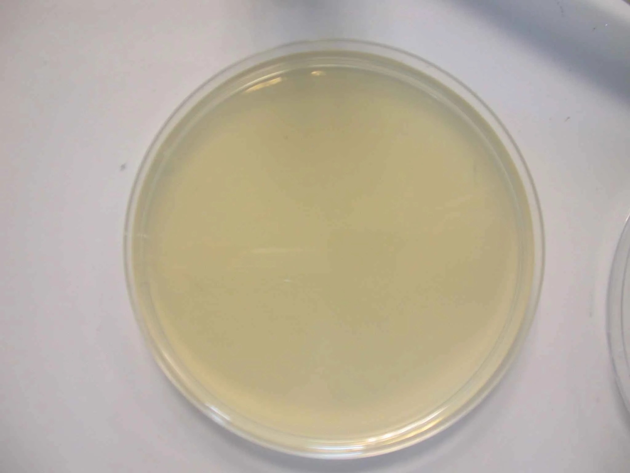 Nutrient Agar Composition, Preparation and Uses
